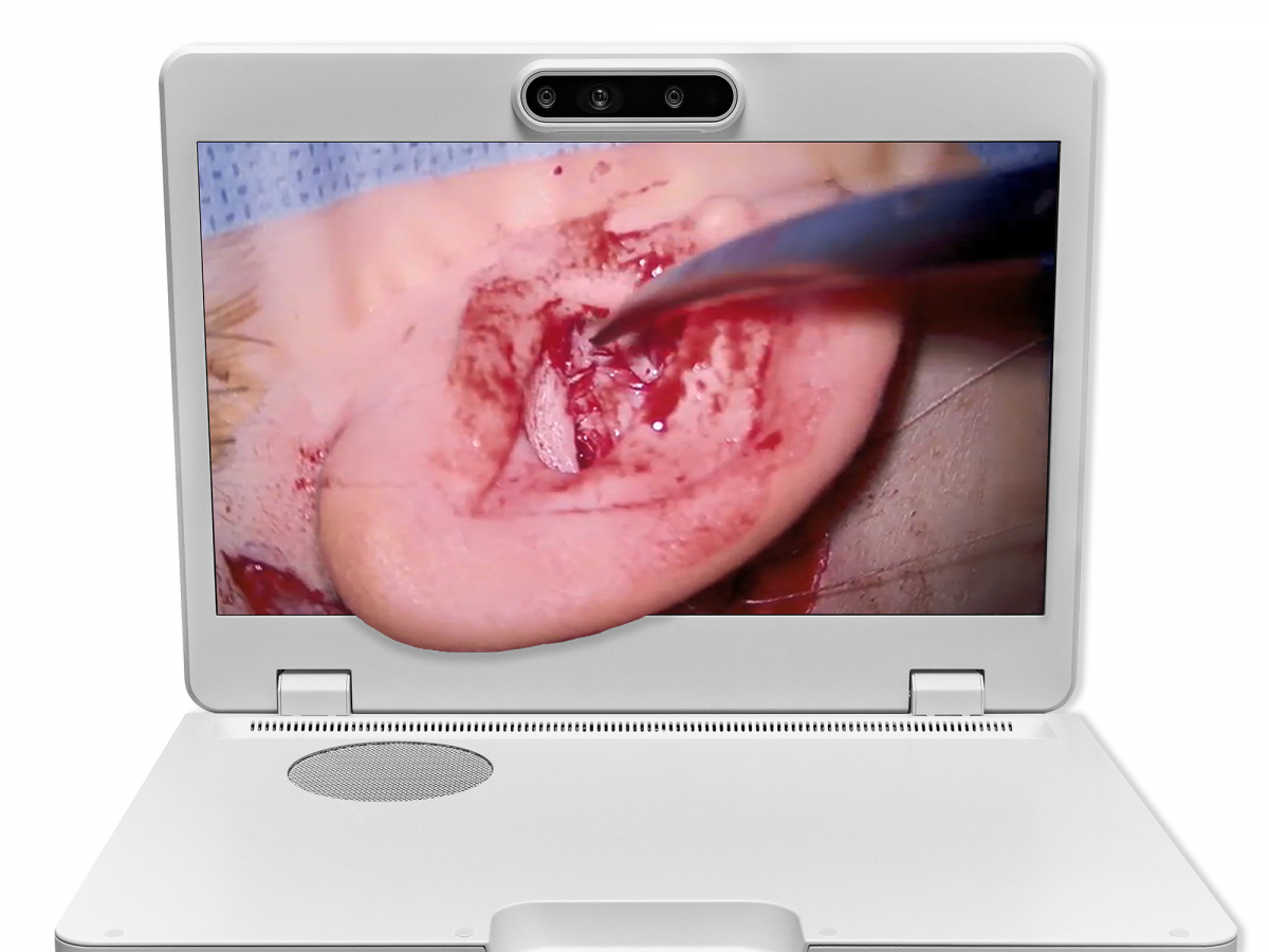 达擎之＂Heads-up 3D显微手术显示系统＂，整合4K裸眼3D显示及眼球追踪系统，具备快速追踪人眼移动位置功能，减轻医师长时间维持固定姿势的负担，让医师能有更宽广清晰的3D立体视野及更舒适的姿势来执行手术。